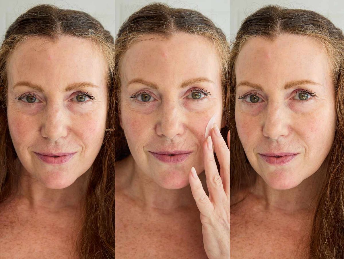 Skin barrier care and the new skincare standard